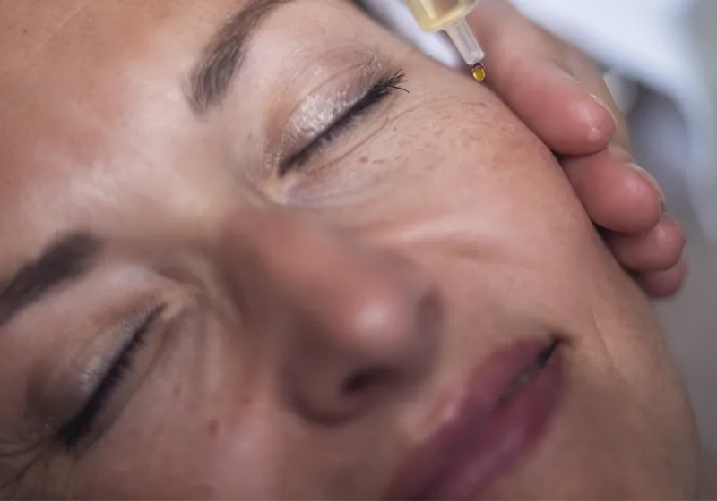 Nahaufnahme eines Gesichts einer Person mit geschlossenen Augen. Eine Hand hält eine Pipette, aus der ein Tropfen einer Flüssigkeit in die Nähe des Auges aufgetragen wird. Die Haut wirkt entspannt.